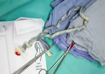 umbilical cord stem cells autism clinical trial panama umbilical cord stem cells autism clinical trial panama